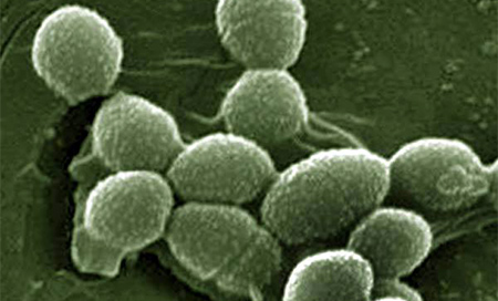 Una bacteria que habita en nuestro organismo puede producir electricidad 